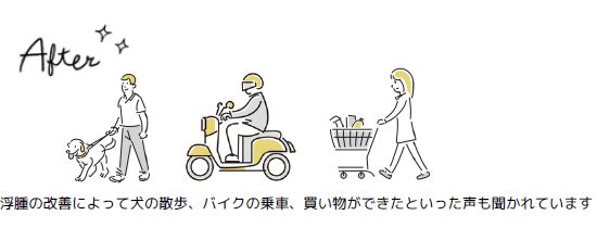 浮腫の改善によって犬の散歩、バイクの乗車買い物ができた声も聴かれます